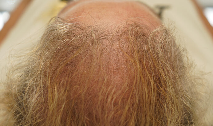 After